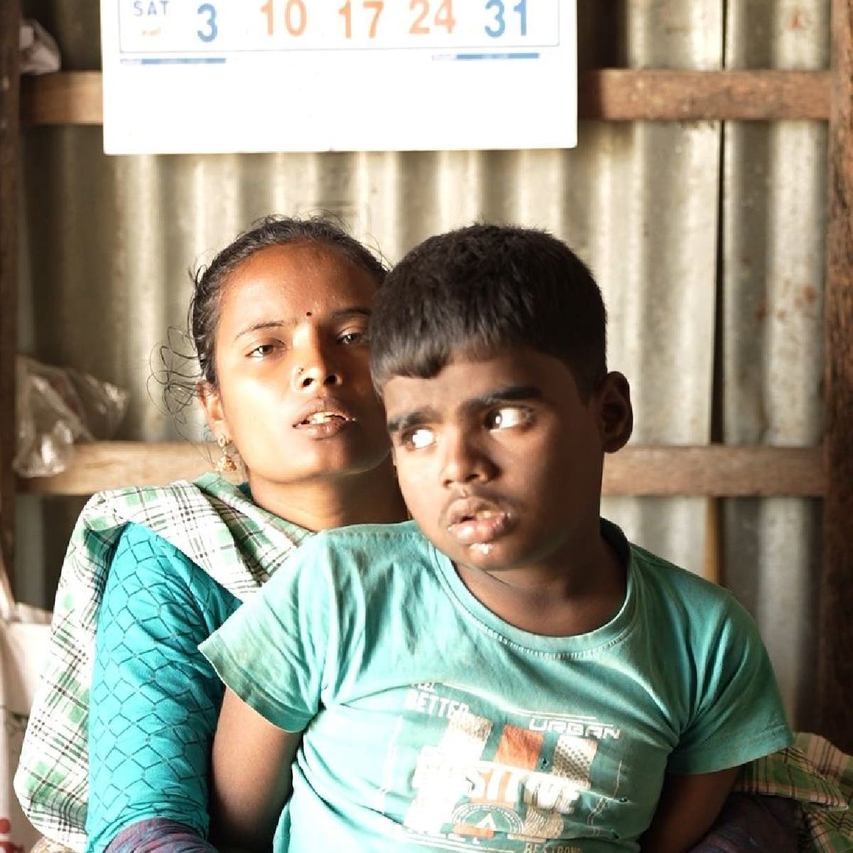 ஒரு தாயின் கண்ணீர் போராட்டம் | Brain Disorder Child Medical Help | Save Vinoth Kumar